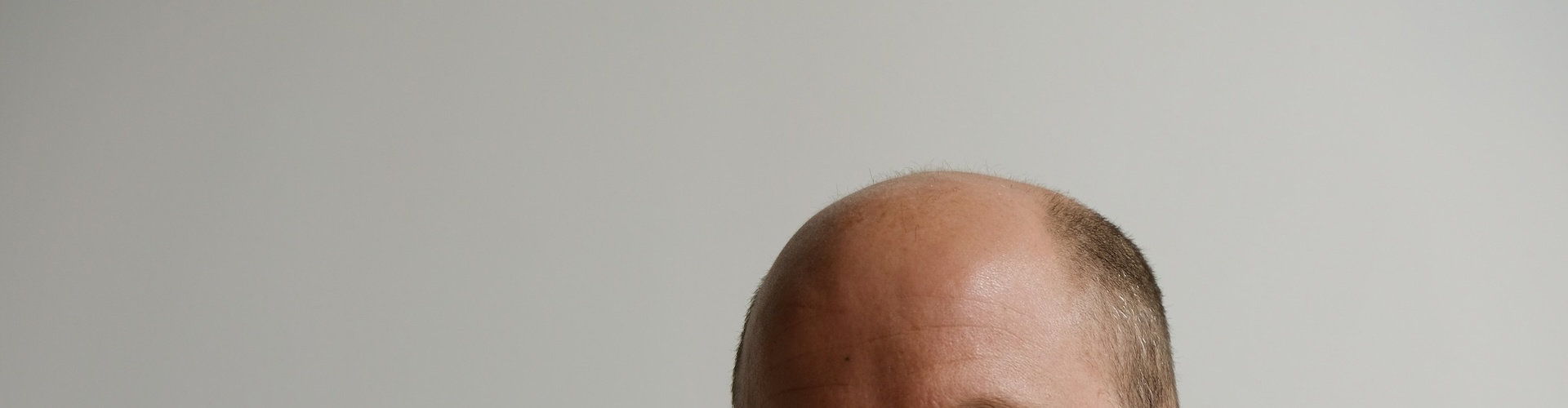 Hårtap Mann