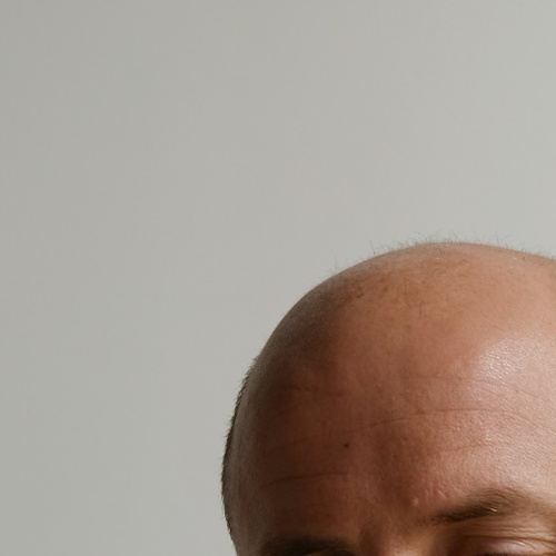 Hårtap Mann
