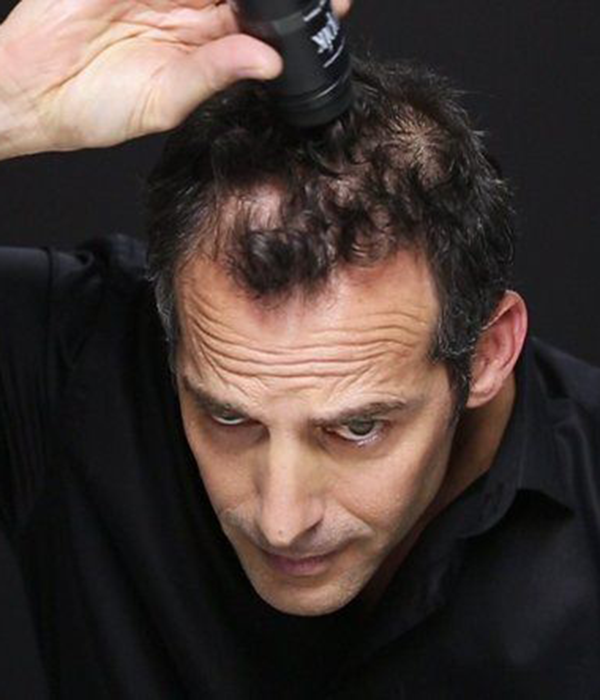 En mann bruker Toppik-pulver i hodebunnen